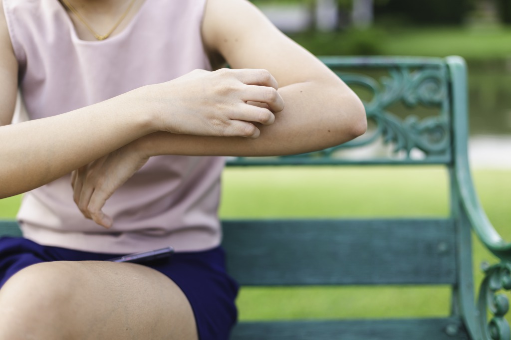 CBDがアトピー等の皮膚炎に効果アリ！？